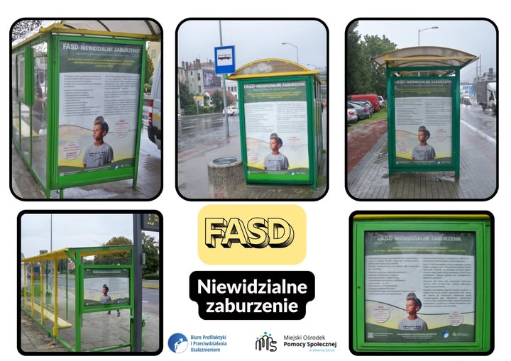 FASD (Spektrum Płodowych Zaburzeń Alkoholowych)